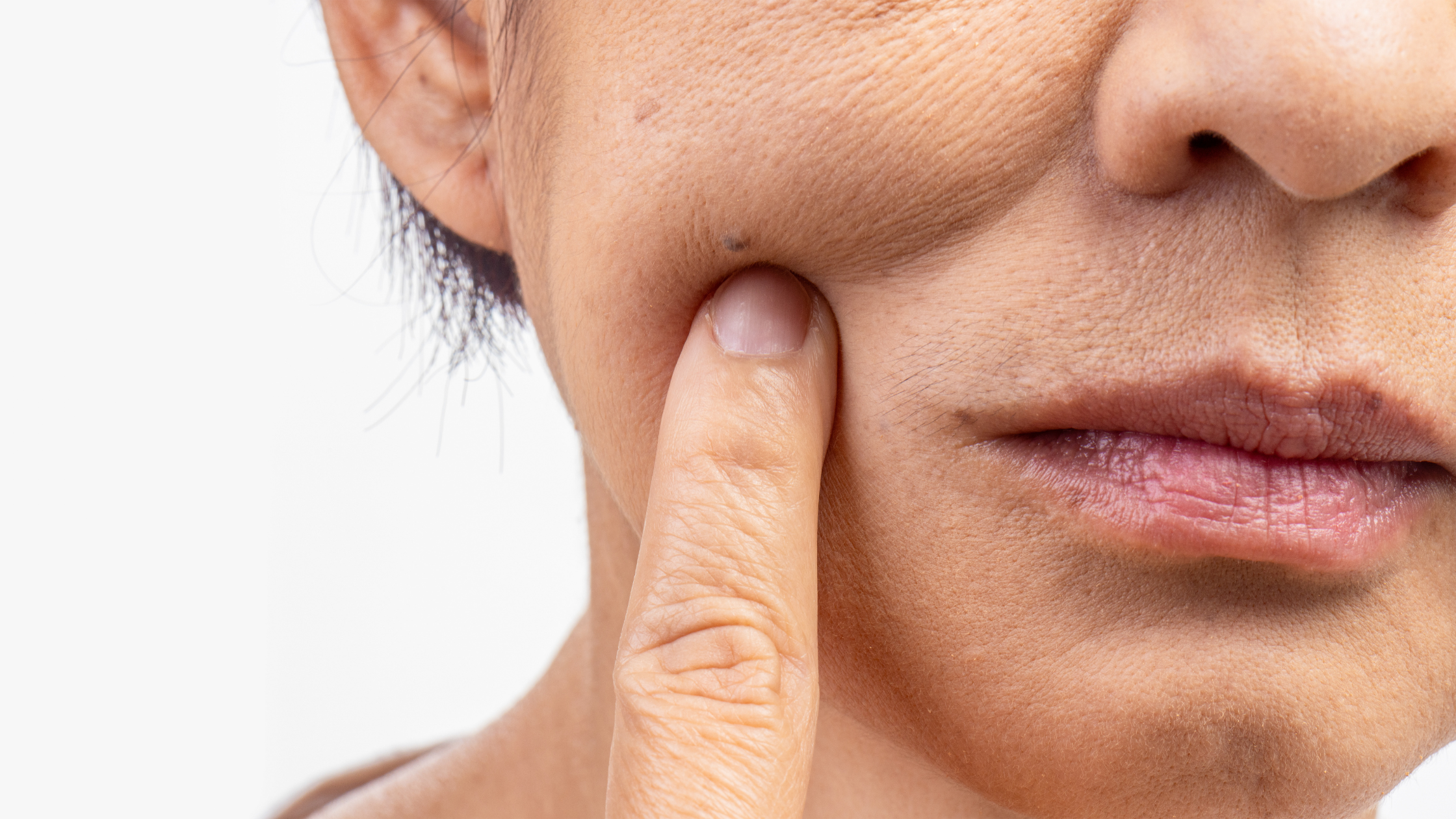 You are currently viewing How to Tighten Sagging Jowls Without Surgery